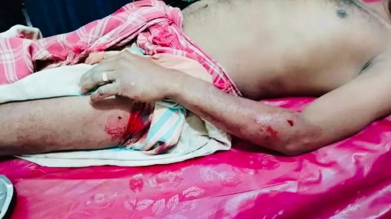 কুষ্টিয়ার দৌলতপুরে মধ্যযুগীয় কায়দায় পেরেক ঢুকিয়ে নির্মম নির্যাতন...